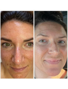 Osmosis Retinal Infusion Peel POWERFUL Twarz+Szyja+Dekolt